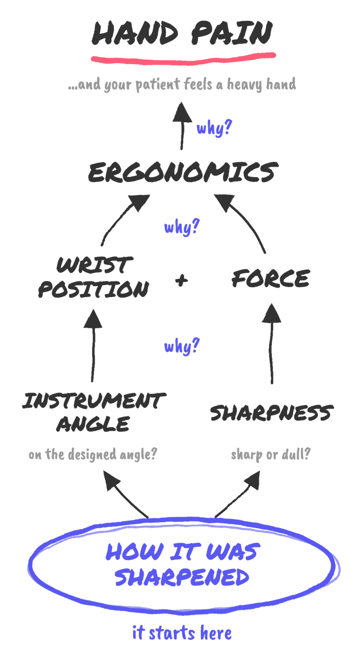Diagram: hand pain traces back to ergonomics: wrist position plus force. Wrist position traces back to the instrument angle (is it on the designed angle?), and force traces back to sharpness (sharp or dull?). Both start with how the instrument was sharpened. Your patient feels it too, as a heavy hand.